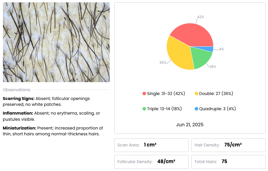 Ai Results Preview Ai Results Preview