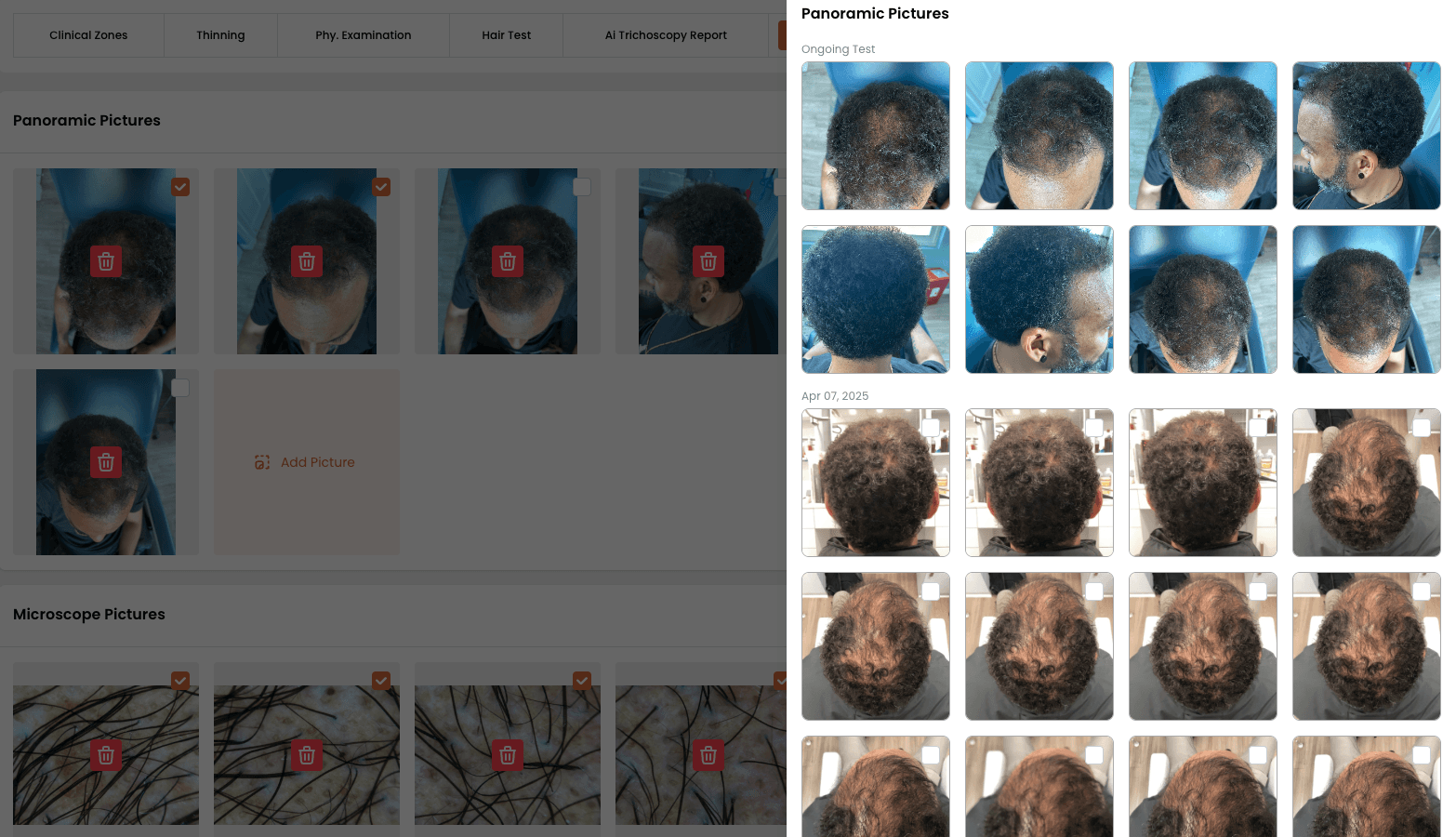 Scalp Pictures Scalp Pictures